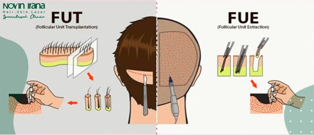 تقنيتي
